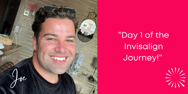  Joe McElderry Starts Invisalign!