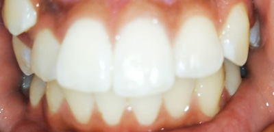 Before