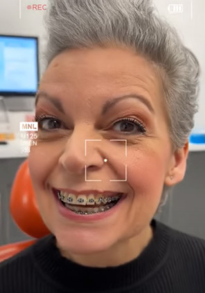 Joanne's confident new smile!