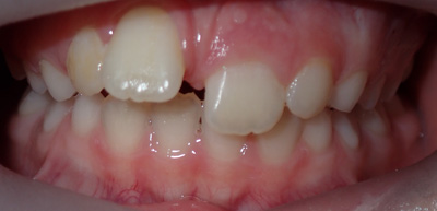 Before