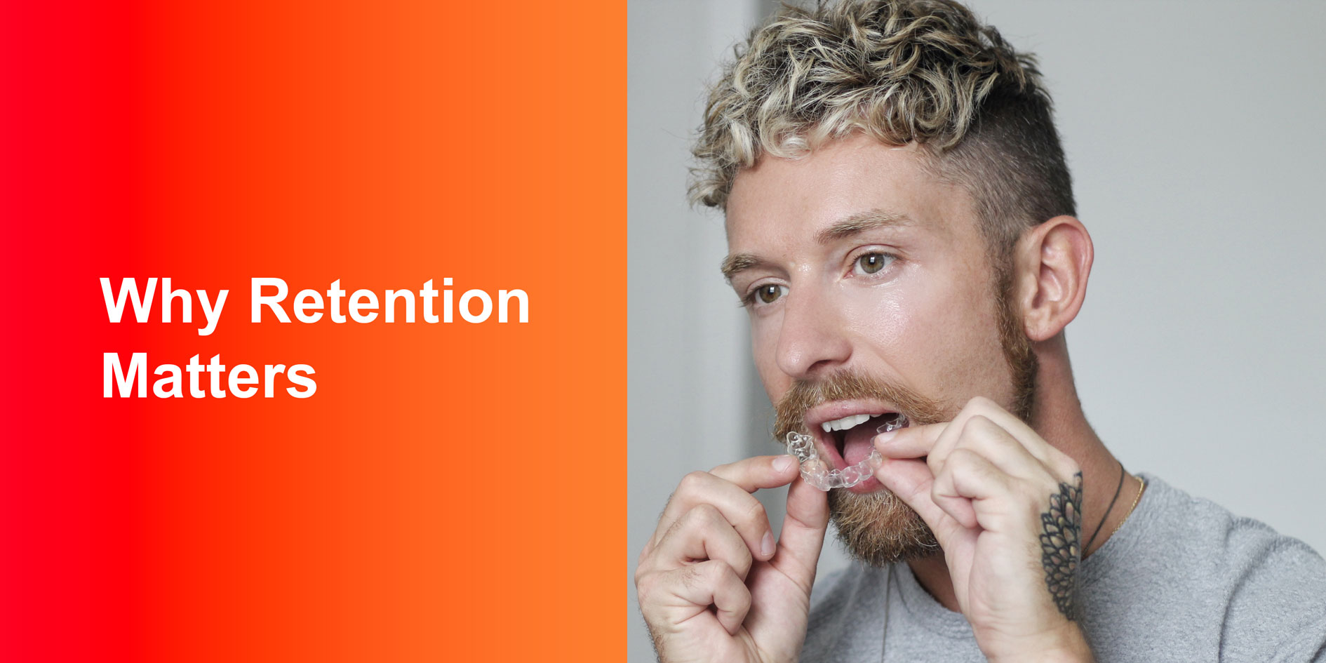 Will My Teeth Move Back If I Forget to Wear My Retainers? Why Retention Matters