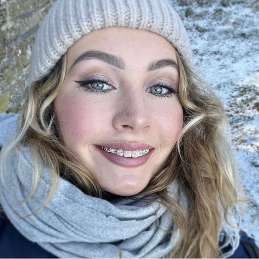 Braces