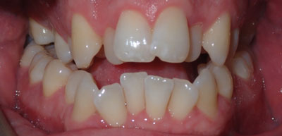 Before