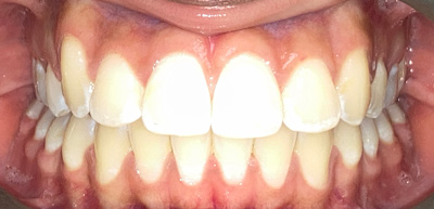 After