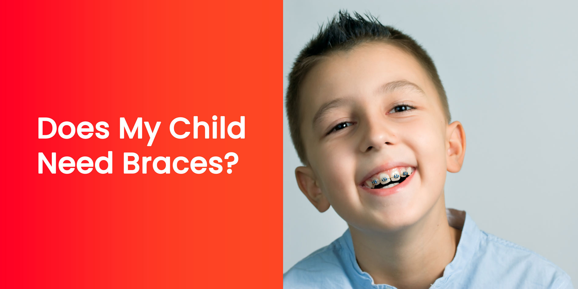 Does My Child Need Braces? Key Signs, Expert Tips, and Early Orthodontic Advice Does My Child Need Braces? Key Signs, Expert Tips, and Early Orthodontic Advice